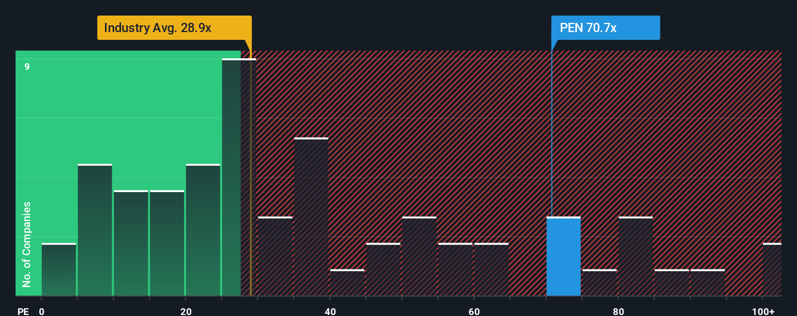 pe-multiple-vs-industry