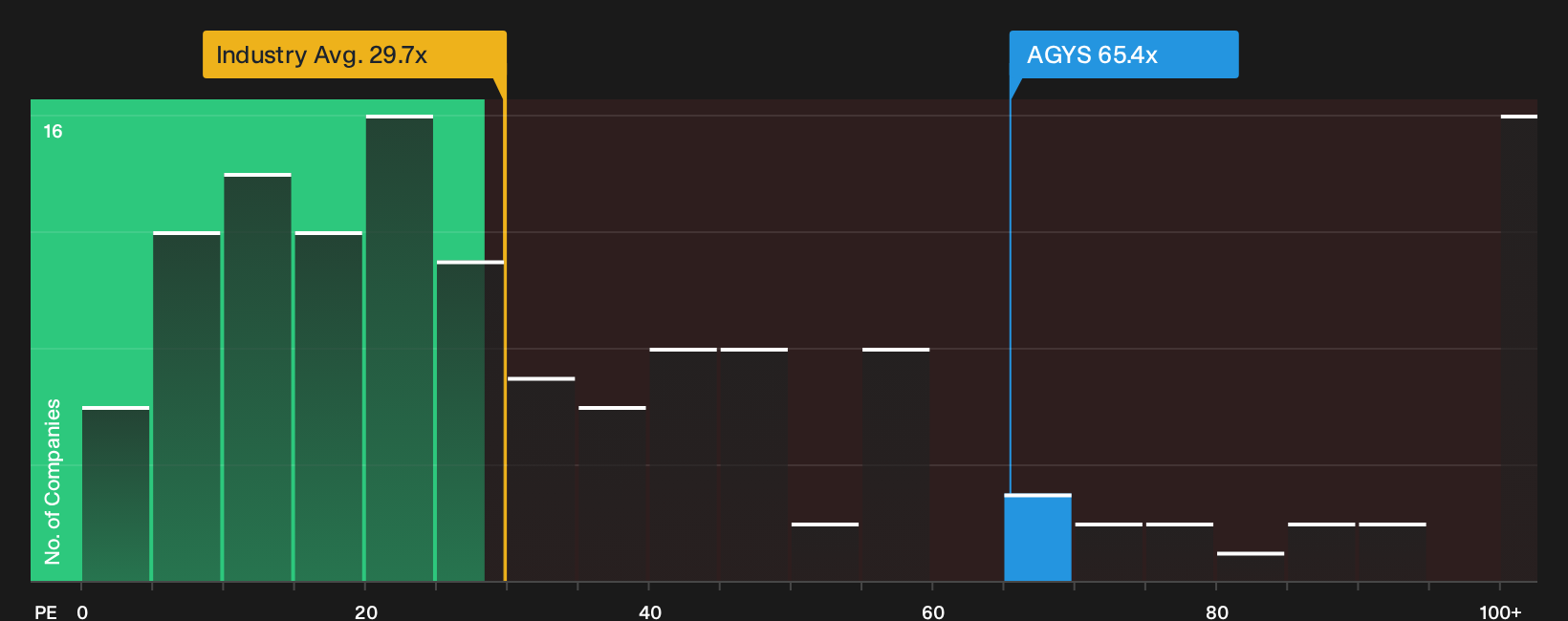 NasdaqGS:AGYS P/E Ratio as at Sep 2026