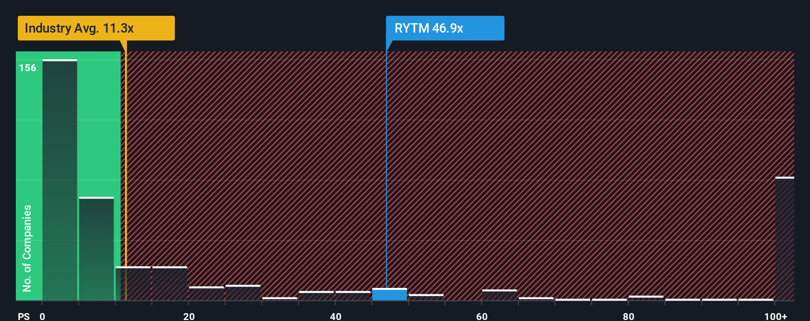 NasdaqGM:RYTM PS Ratio as at Oct 2025